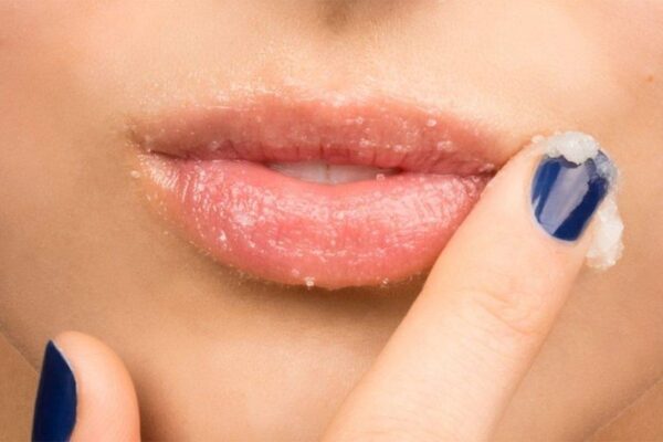 Berikut Adalah Tips Ampuh Mengatasi Bibir Gelap